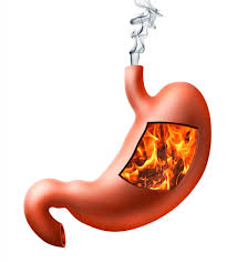 Top 5 Heartburn Causes