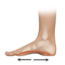 Plantar Fasciitis Prevention And Treatment